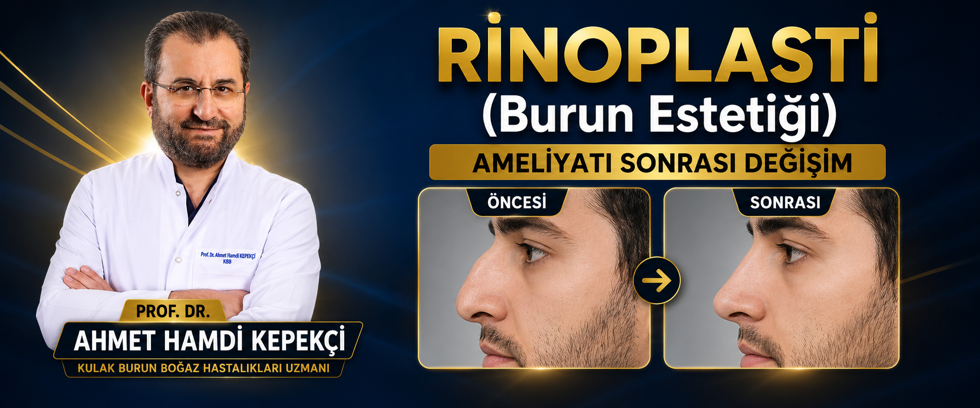 Kişiye Özel Burun Estetiği: Rinoplasti Hakkında Bilmeniz Gerekenler