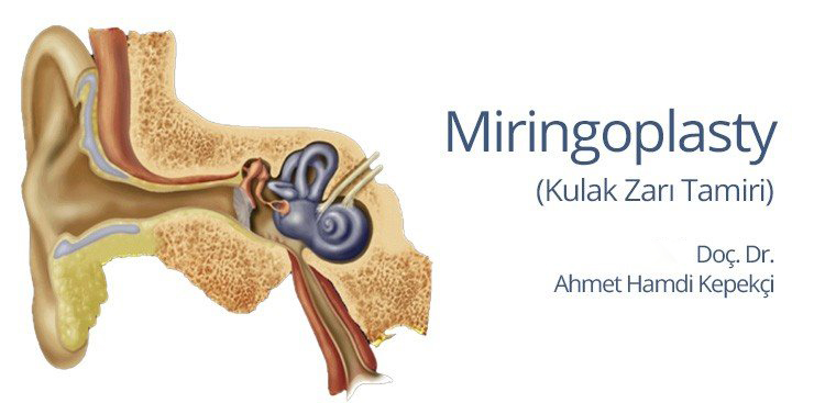 Miringoplasti Ameliyatı