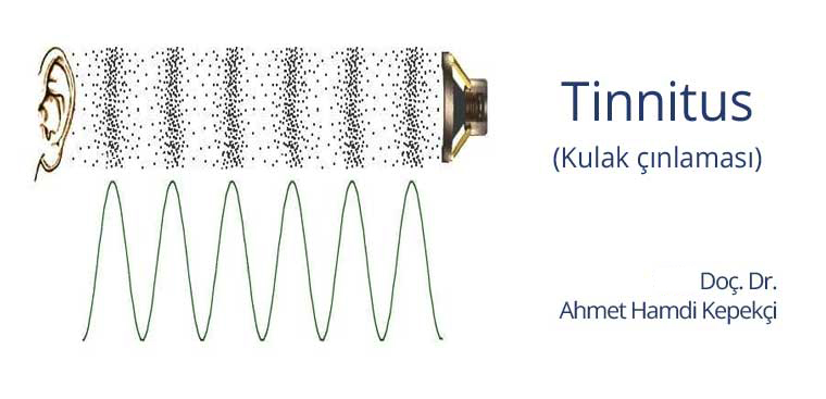 Kulak Çınlaması Tedavisi